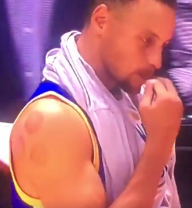 Steph Curry Suction Cup Marks